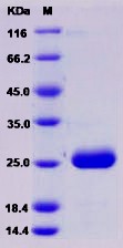 Recombinant Rat PRL2A1 / Prolactin-2A1 Protein (His Tag)