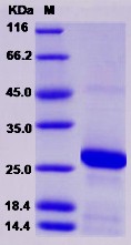 Recombinant Rat RAB7A / Rab-7a Protein (His tag)