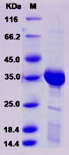 Recombinant Rat HAAO / 3-HAO Protein (His tag)