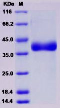 Recombinant Rat Cathepsin B / CTSB Protein (His Tag)
