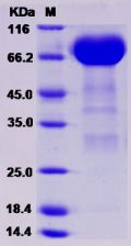 Recombinant Rat EphA3 Protein (His tag)