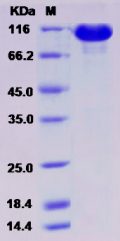 Recombinant Rat EphA3 Protein (Fc tag)