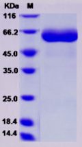 Recombinant Rat IL-22R / IL22RA1 Protein (ECD, Fc Tag)