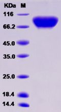Recombinant Rat CSF1R / MCSF Receptor / CD115 Protein (His tag)