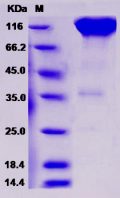 Recombinant Rat PDGFRa / CD140a Protein (Fc tag)