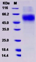 Recombinant Rat MSR1 / SCARA1 Protein (His tag)
