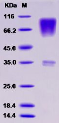 Recombinant Rat CD164 / Endolyn Protein (Fc tag)