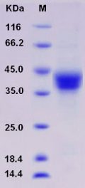 Recombinant Rat CD157 / BST1 Protein (His tag)