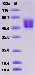 Recombinant Rat Syndecan-1 / SDC1 / CD138 Protein (His tag)