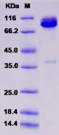 Recombinant Rat Syndecan-1 / SDC1 / CD138 Protein (Fc tag)