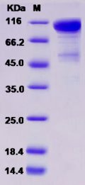 Recombinant Rat DDR2 Kinase / CD167b Protein (Fc tag)