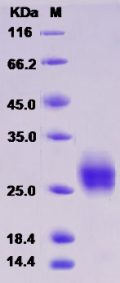 Recombinant Rat CD90 / THY-1 Protein (His tag)