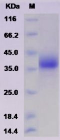 Recombinant Rat LILRA5 Protein (His tag)