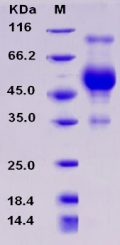 Recombinant Rat CD83 Protein (Fc tag)