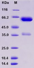 Recombinant Rat EpCAM / TROP-1 / TACSTD1 Protein (Fc tag)