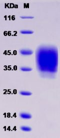 Recombinant Rat CD48 / SLAMF2 / BCM1 Protein (His tag)