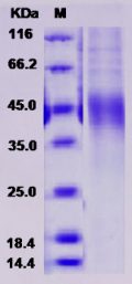 Recombinant Rat OLR1 / LOX1 Protein (His tag)