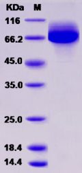 Recombinant Rat CD36 / SCARB3 Protein (His tag)