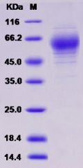 Recombinant Rat HepaCAM2 Protein (His tag)