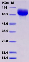 Recombinant Rat HepaCAM2 Protein (Fc tag)