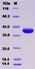 Recombinant Rat MDHA / MDH1 Protein (His tag)
