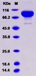 Recombinant Rat IL13RA2 / IL13R Protein (Fc tag)