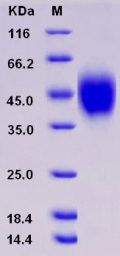 Recombinant Rat IL2RG / CD132 Protein (His tag)