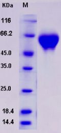Recombinant Rat IL1R2 / IL1RB / CD121b Protein (His tag)