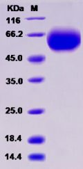 Recombinant Rat IL18R1 Protein (His tag)