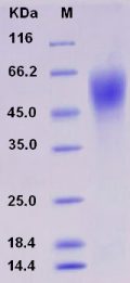 Recombinant Rat IL17RA / IL17R Protein (His tag)
