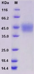 Recombinant Rat IL-21R / Interleukin-21 Receptor Protein (His tag)