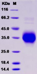 Recombinant Rat TNFR1 / CD120a / TNFRSF1A Protein (His tag)
