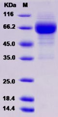 Recombinant Rat LTBR / TNFRSF3 Protein (Fc tag)