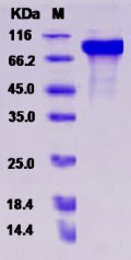 Recombinant Rat HER4 / ErbB4 Protein (His tag)
