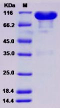 Recombinant Rat EphA7 / Eph Receptor A7 Protein (Fc Tag)