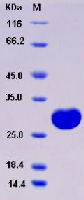 Recombinant Rat UCHL1 / PGP9.5 Protein (His tag)