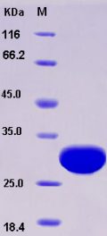 Recombinant Rat UCHL3 Protein (His tag)