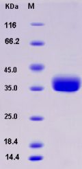 Recombinant Rat IL9R / Interleukin 9 receptor Protein (His tag)