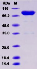 Recombinant Rat UNC5B / UNC5H2 Protein (Fc tag)
