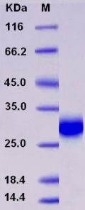 Recombinant Rat TIMP-1 / TIMP1 Protein