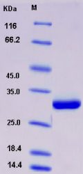 Recombinant Rat Serum amyloid P component / APCS / SAP Protein (His tag)