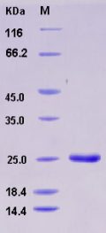 Recombinant Rat LCN2 / NGAL Protein (His tag)