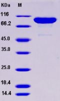 Recombinant Rat MMP-9 / CLG4B Protein (His tag)