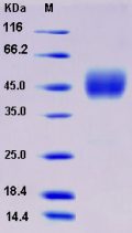 Recombinant Rat Neurexophilin-1 / NXPH1 Protein (His tag)