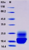 Recombinant Rat Cystatin C / CST3 Protein (His tag)