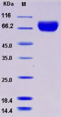 Recombinant Rat E-Selectin / CD62e / SELE Protein (His tag)