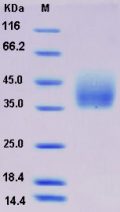 Recombinant Rat Growth Hormone Receptor / GHR / GHBP Protein (His tag)