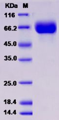 Recombinant Rat Growth Hormone Receptor / GHR / GHBP Protein (Fc tag)