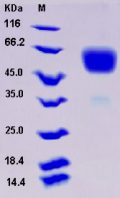 Recombinant Rat IL1R1 / CD121a Protein (His tag)