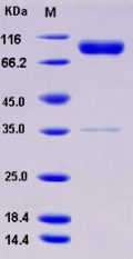 Recombinant Rat IL1R1 / CD121a Protein (His & Fc tag)